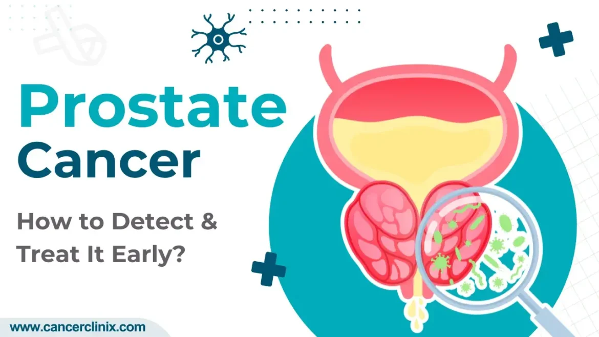 Prostate-Cancer