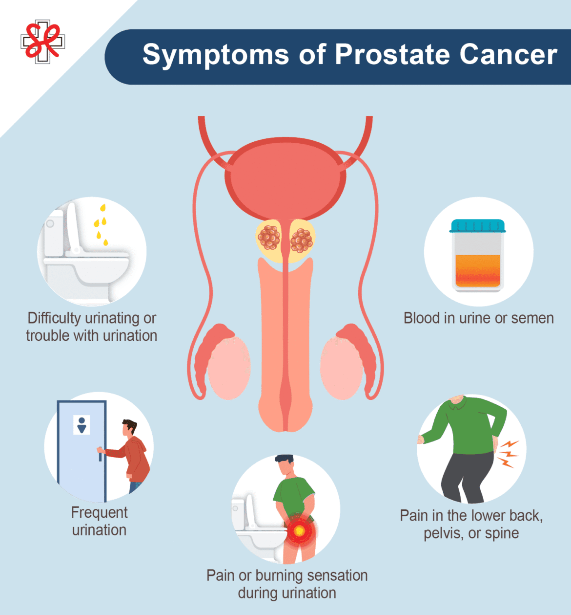 Symptoms of Prostate Cancer (1)